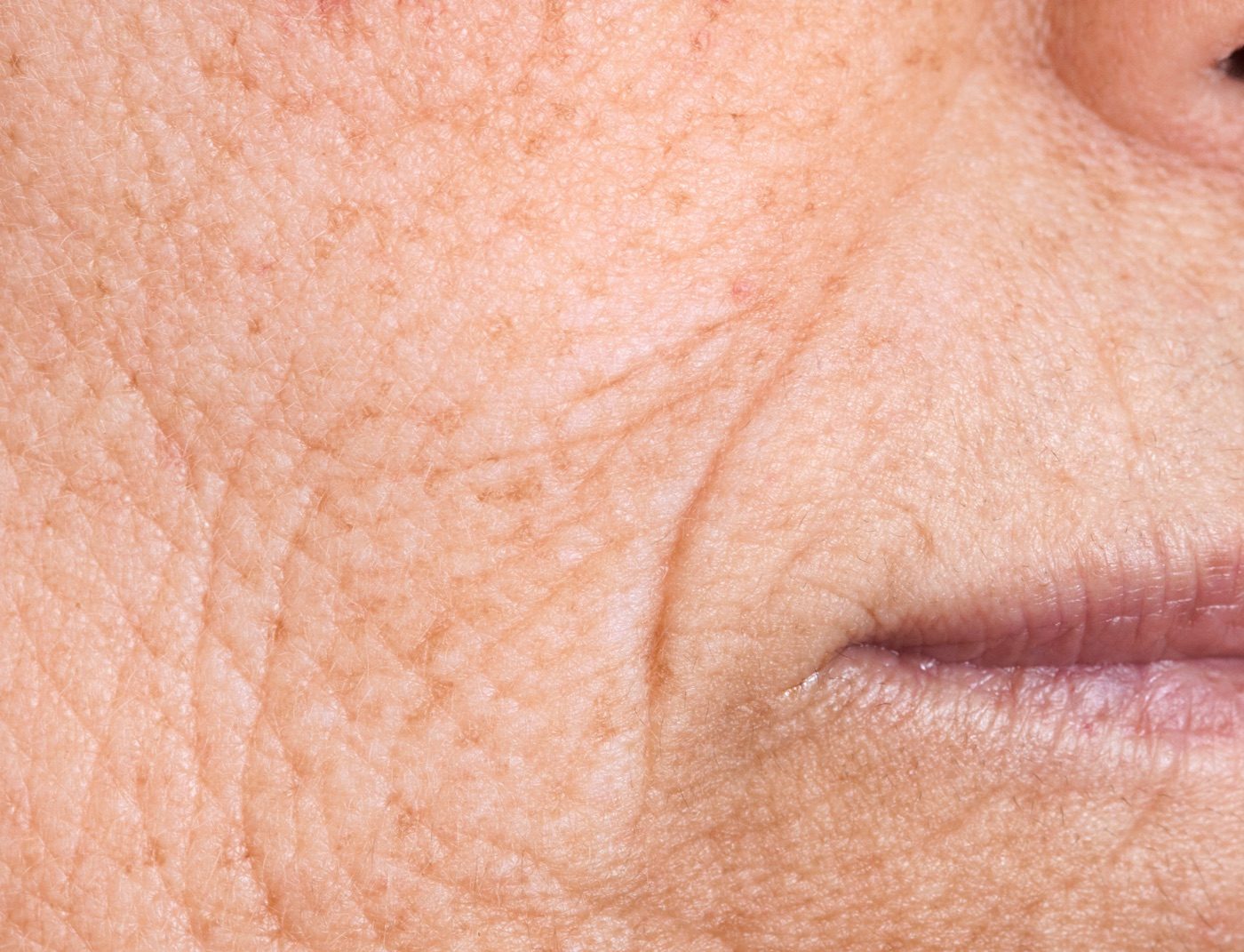 Pelle del viso, trattamento anti-age